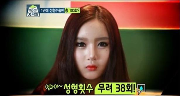 韩国三名女性患"整容成瘾症" 1年整容上百次